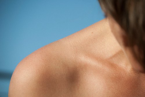 Clavicle Collarbone Pain