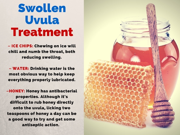 What To Do For A Swollen Throat 85