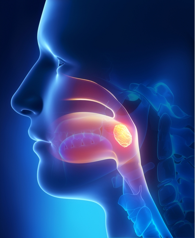 What are some remedies for a sore soft palate?