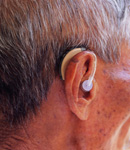 Reducing levels of homocysteine while boosting folate intake could protect against hearing loss. 