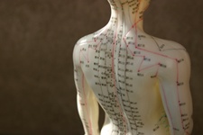 This Uncommon Type of Acupuncture Could Boost Brain Function after a Stroke