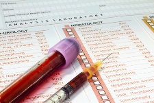 The U.S. Preventative Task Force is recommending testing for hepatitis C for all baby boomers.