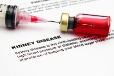 More people need to be aware of the dangers of kidney disease