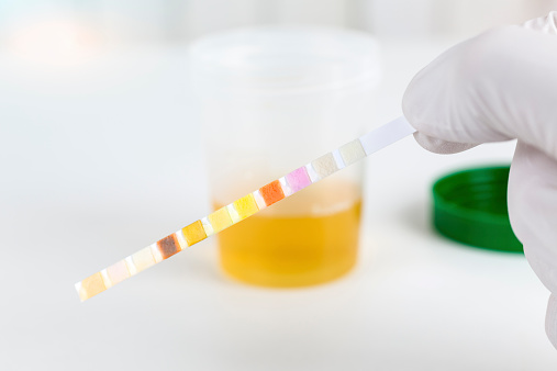 testing ketones in urine