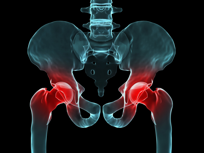 Take This Supplement Combination to Reduce Your Risk of Hip Fracture