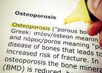 The Osteoporosis and Vitamin D and Walking