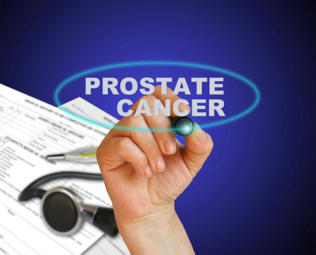 Diagnosis of Prostate Cancer
