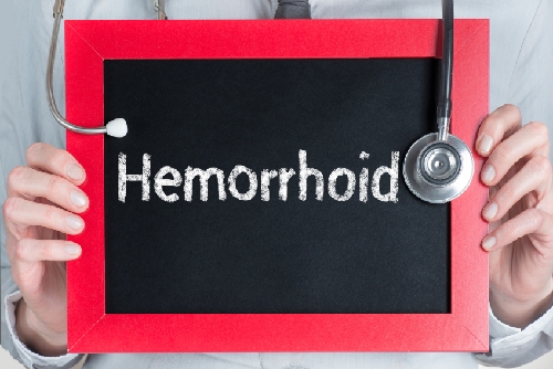 How Long Do Hemorrhoids Last