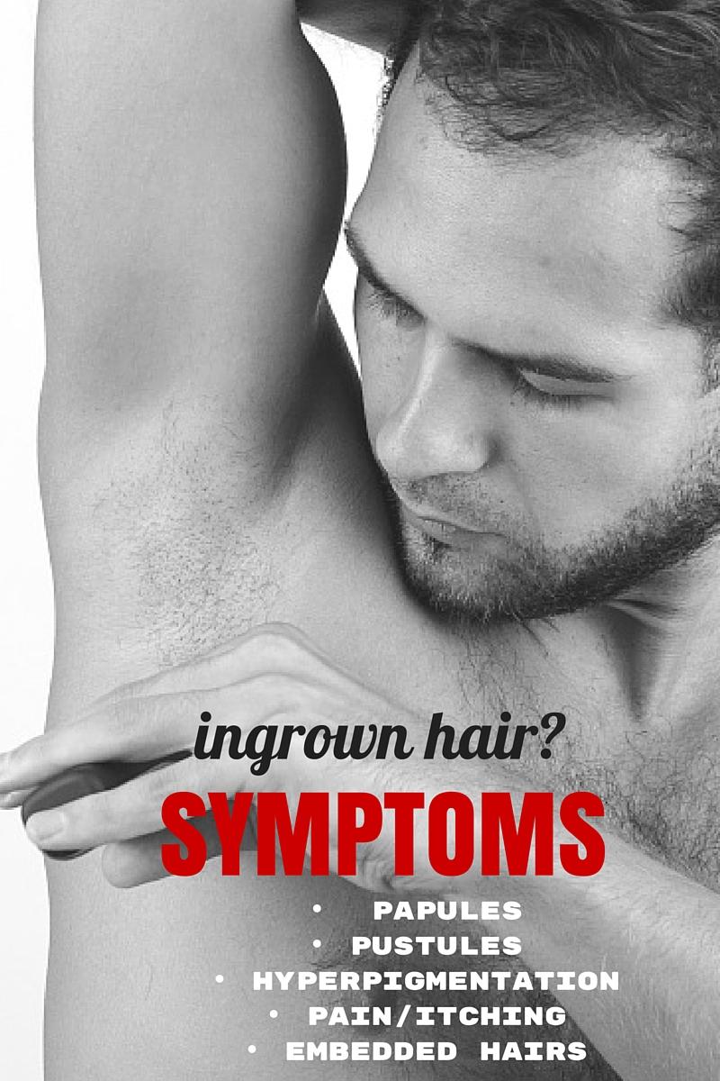 ingrown hair symptoms