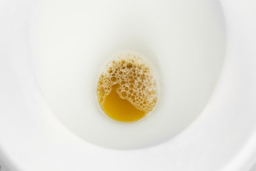 Are a Few Bubbles in Urine Normal?
