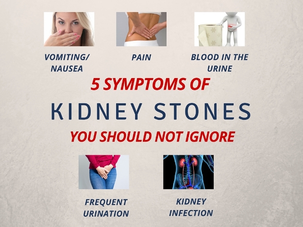 Symptoms-of-Kidney-Stones