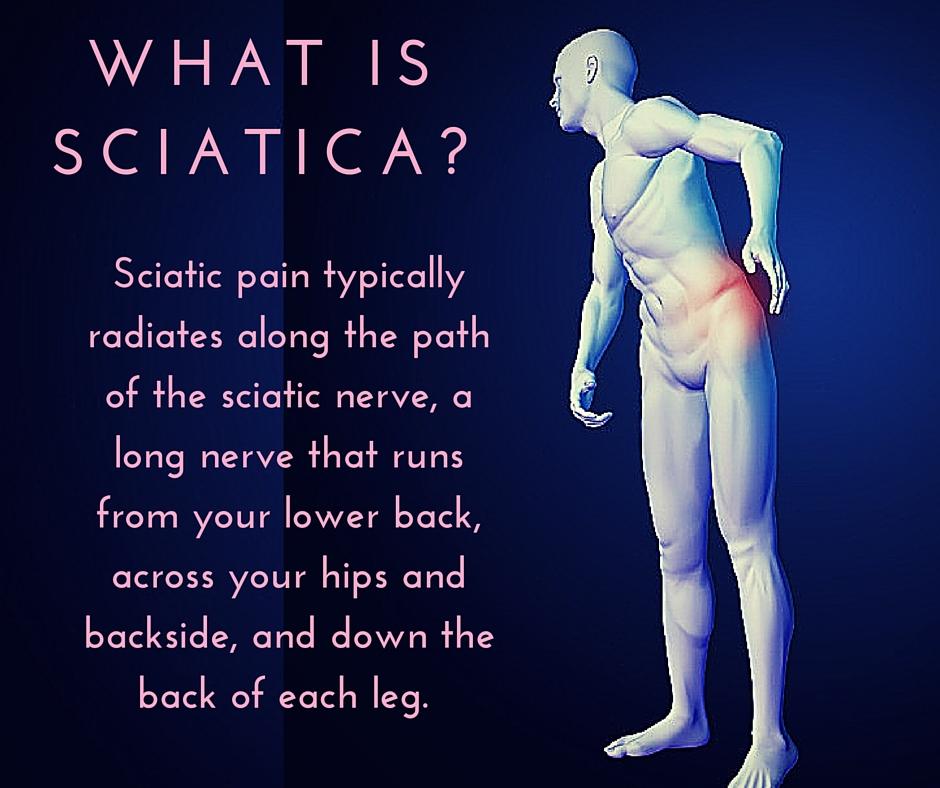 sciatica pain