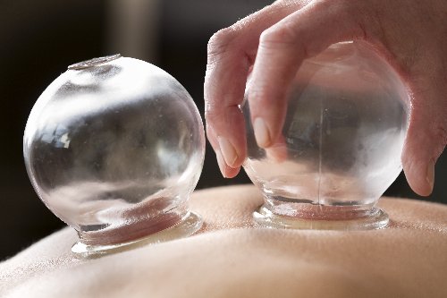 traditional Chinese medicine cupping therapy