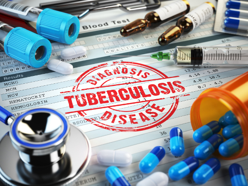 Is Tuberculosis Contagious