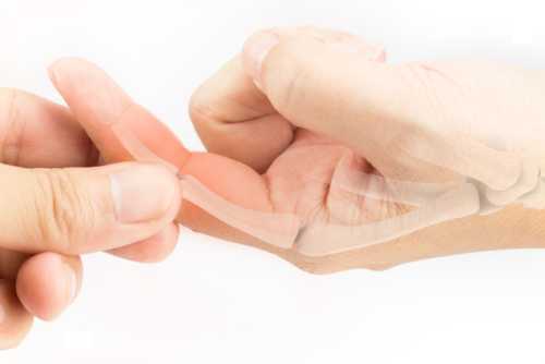 Sprained Fingers Causes, Symptoms, and Treatments