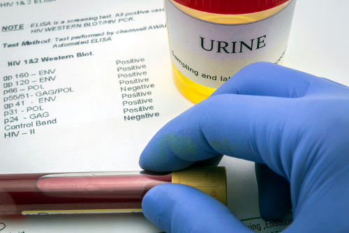 Tests for Research of urine