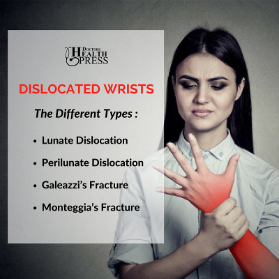 Wrist dislocation