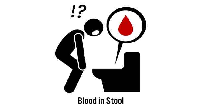 blood-in-stool