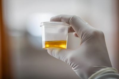 oily urine